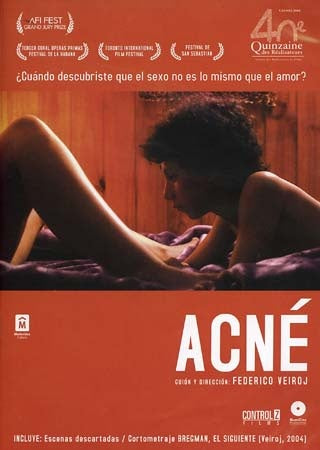 ACNE | ARTISTAS VARIOS, VEIRO J