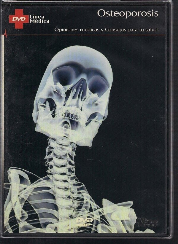 OSTEOPOROSIS | AUTORES VARIOS