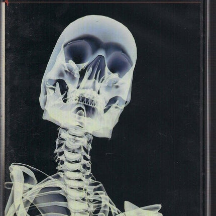 OSTEOPOROSIS | VARIOS